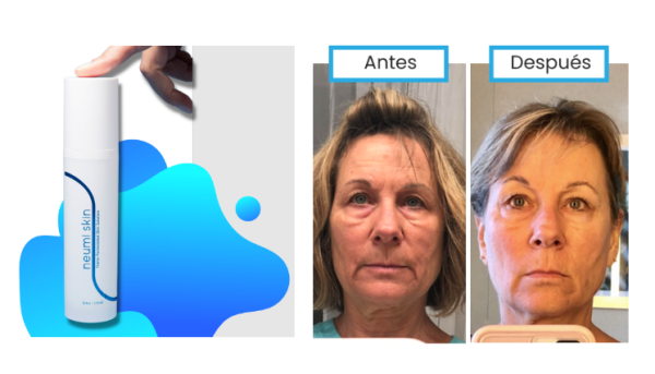 Neumi Skin Costa Rica